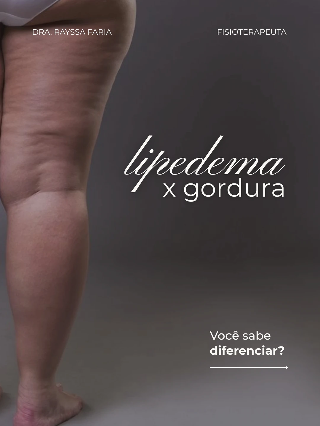 Dra. Rayssa Faria · Lipedema x gordura, 1 de 6